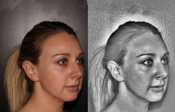 Aesthetic Photography System to track your Skin Treatment Progress post thumbnail